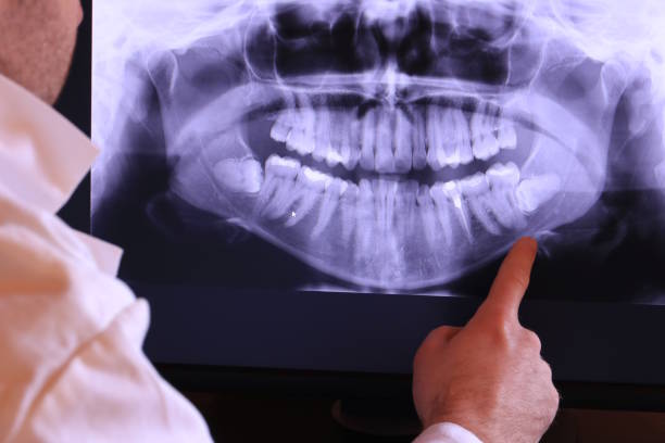 Best Emergency Gum Treatment in Manton, MI