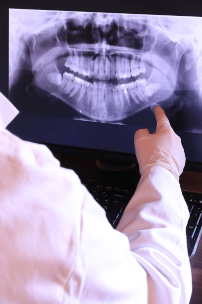 Best Emergency Treatment for Dental Infections or Abscesses in Manton, MI
