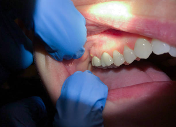 Best Emergency TMJ Treatment in Manton, MI