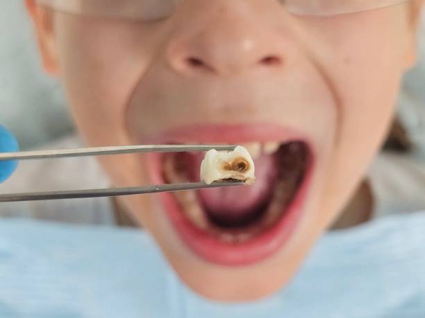 Best Same-Day Emergency Dental Services in Manton, MI